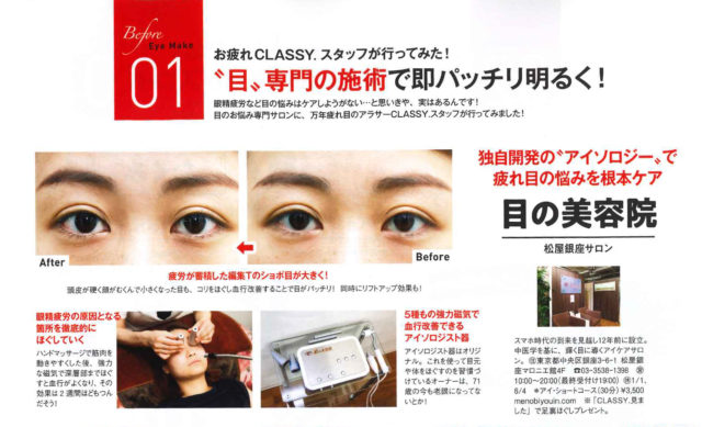 お疲れCLASSY.スタッフが行ってみた！”目”専門の施術で即パッチリ明るい！　眼精疲労など目の悩みはケアしようがない・・と想いきや、実はあるんです！目のお悩み専門サロンに、万年疲れ目のアラサーCLASSY.スタッフが行ってみました！